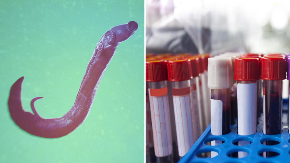 A stock image of a parasite called schistosomiasis on the left and on the right is a photo of blood test tubes.