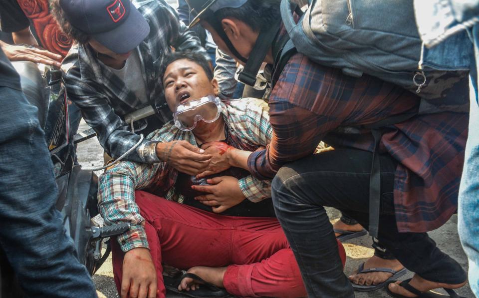 A wounded protester in Mandalay, March 2021 - Anadolu Agency