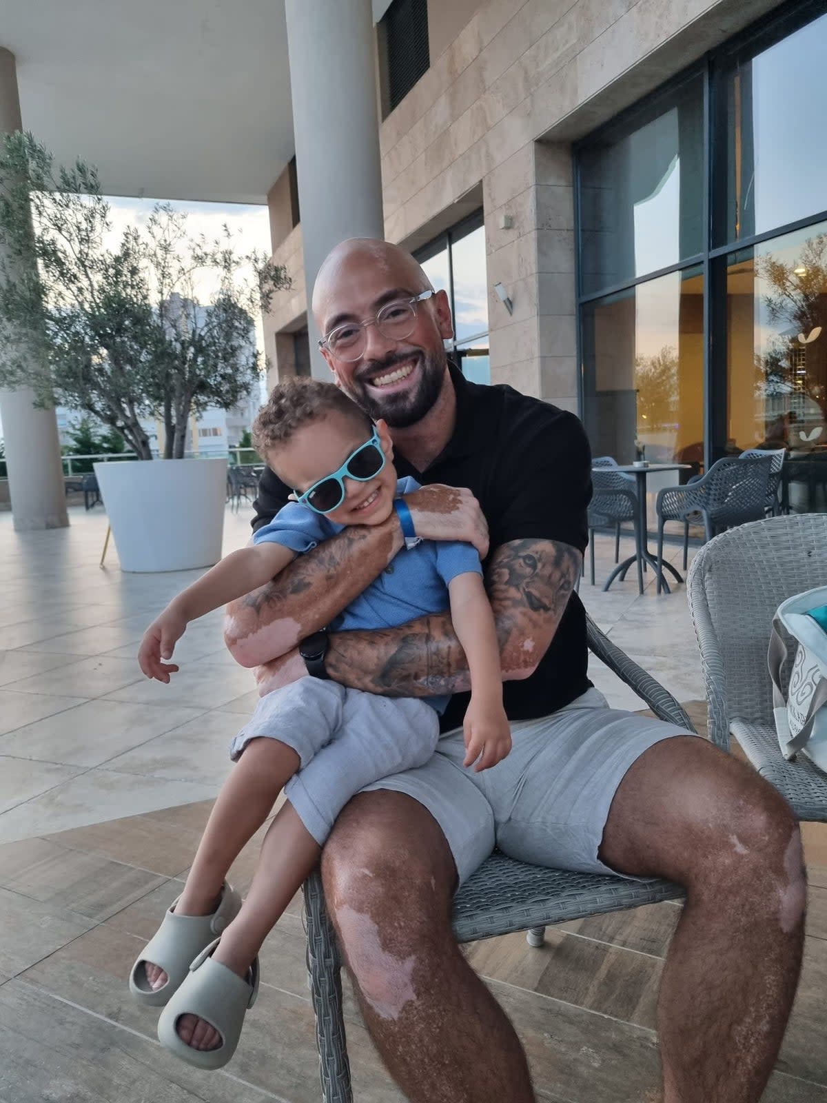 Elj says he wants his children to understand his vitiligo is not a bad thing  (Elj Abid )