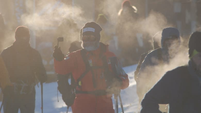 Following frostbite incidents, Yukon Arctic Ultra not making changes to next year's race