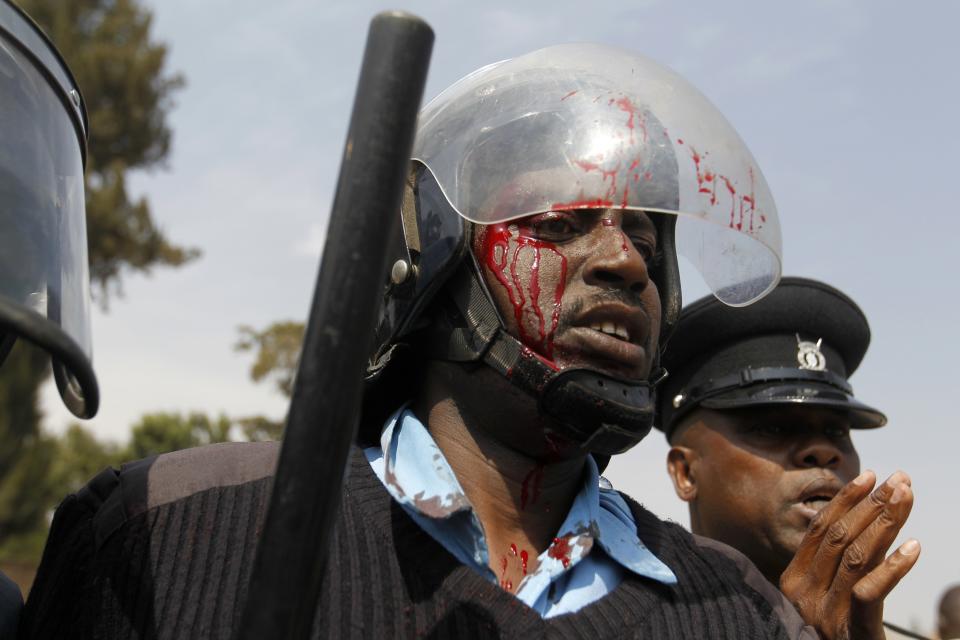 An injured riot policeman is seen during a protest by students of Langata primary school and activist against a perimeter wall erected by a private developer around their school playground in Nairobi