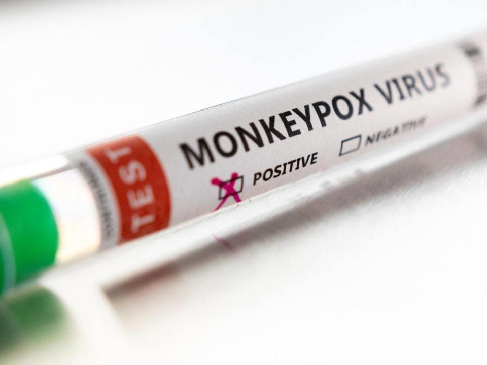 Saskatchewan is reporting its second case of monkeypox.&nbsp; (Dado Ruvic/Reuters - image credit)