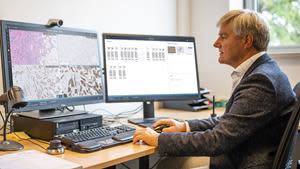 Pathologist reviewing histopathology slides on 2 screens