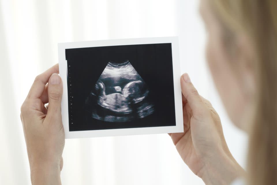 The woman's scan said 2015 in the corner, even though she had just revealed her pregnancy. Photo (stock image): Getty Images