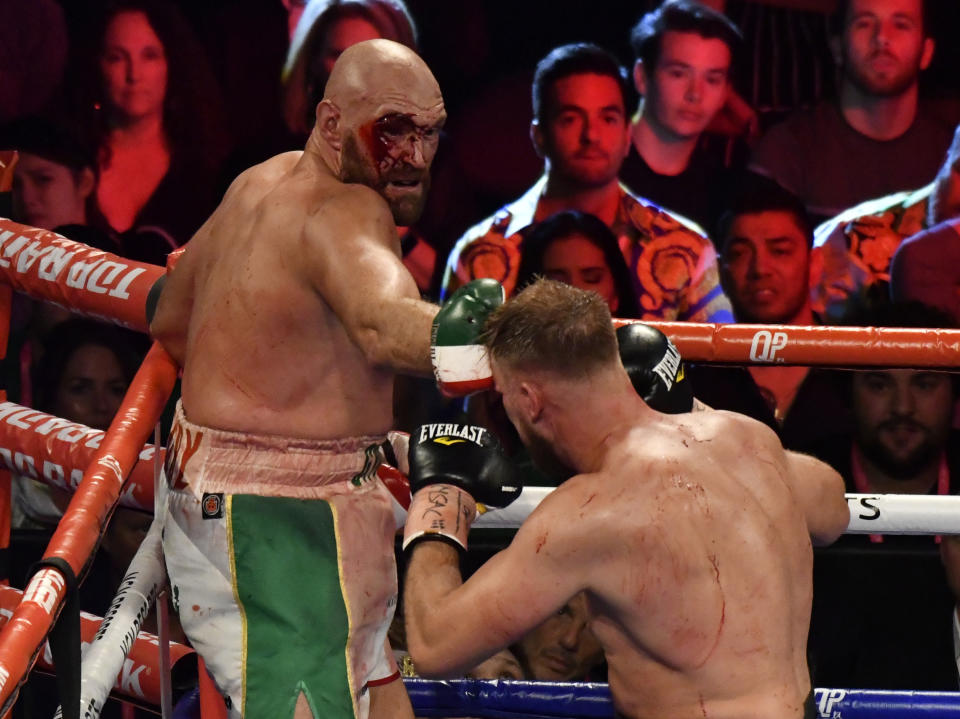 Tyson Fury v Otto Wallin