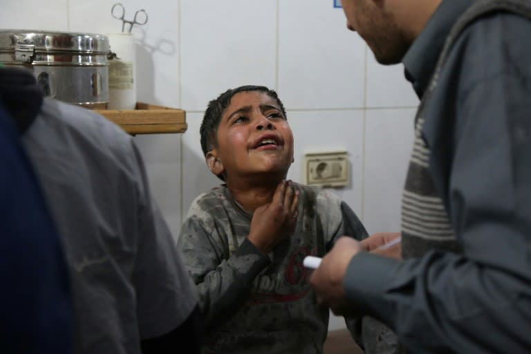 A Syrian boy wounded in reported regime air strikes on the rebel-held enclave of Eastern Ghouta receives treatment at a makeshift hospital in Kafar Batna on March 7, 2018