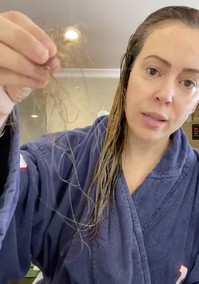 Alyssa brushed out clumps of hair in the video interview. Photo: Twitter