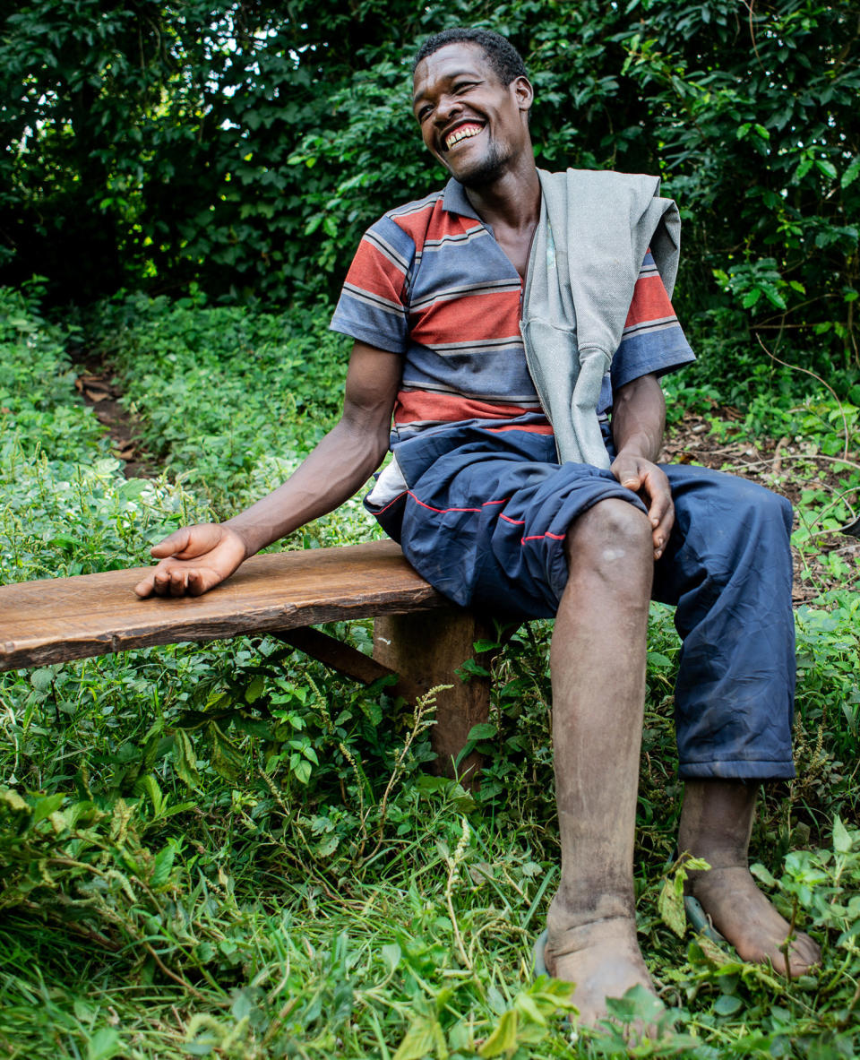 Tesfaye Bezabh in the village of Gesabale in southern Ethiopia has mild podoconiosis and&nbsp;says he rarely wears shoes. (Photo: Tom Gardner for HuffPost)