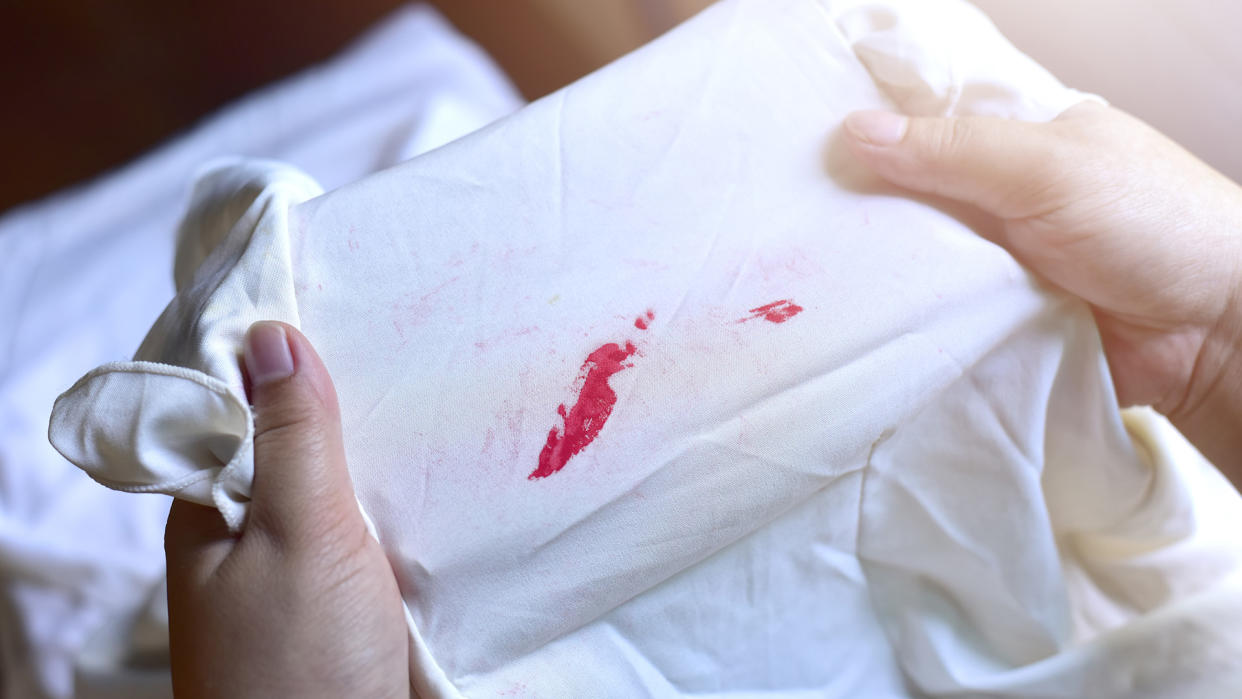  Red ink on white shirt. 