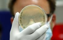Marcel Walser, Director Lead Generation of Swiss biotechnology company Molecular Partners displays a petri dish containing bacterial colonies in a laboratory at the company's headquarters in Schlieren