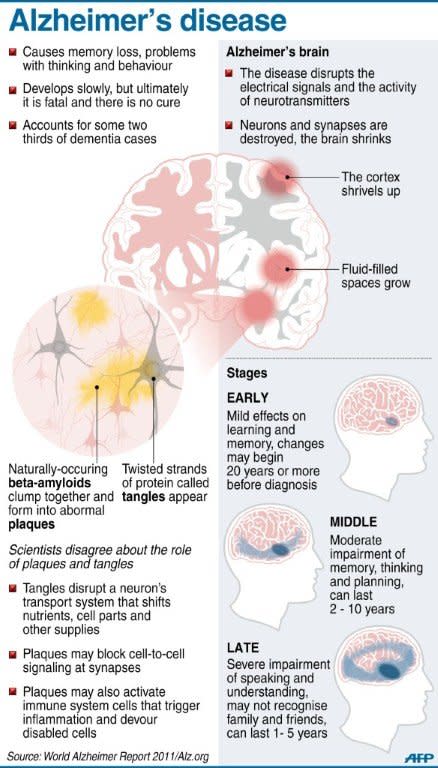 Graphic on Alzheimer's disease. Technology capable of diagnosing the disease long before its symptoms appear has won a coveted honor for innovation at theSXSW festival in the US