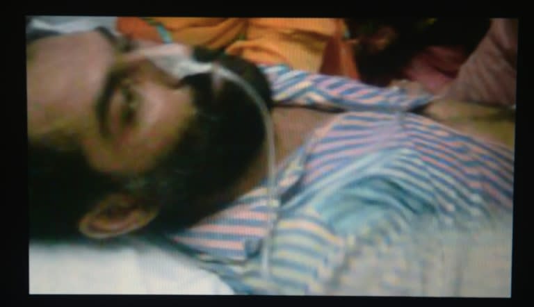 Pakistani prisoner and convicted murdered Abdul Basit lies on a hospital bed in Faisalabad, on September 22, 2015