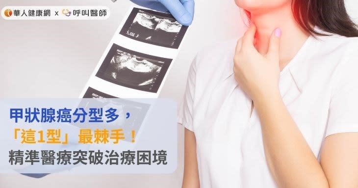 甲狀腺癌分型多，「這1型」最棘手！精準醫療突破治療困境