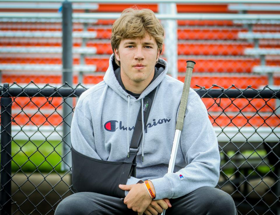 Bridgewater-Raynham lacrosse goalie Nate Carfagna suffered a season-ending clavicle injury in the fourth game of the 2022 season.