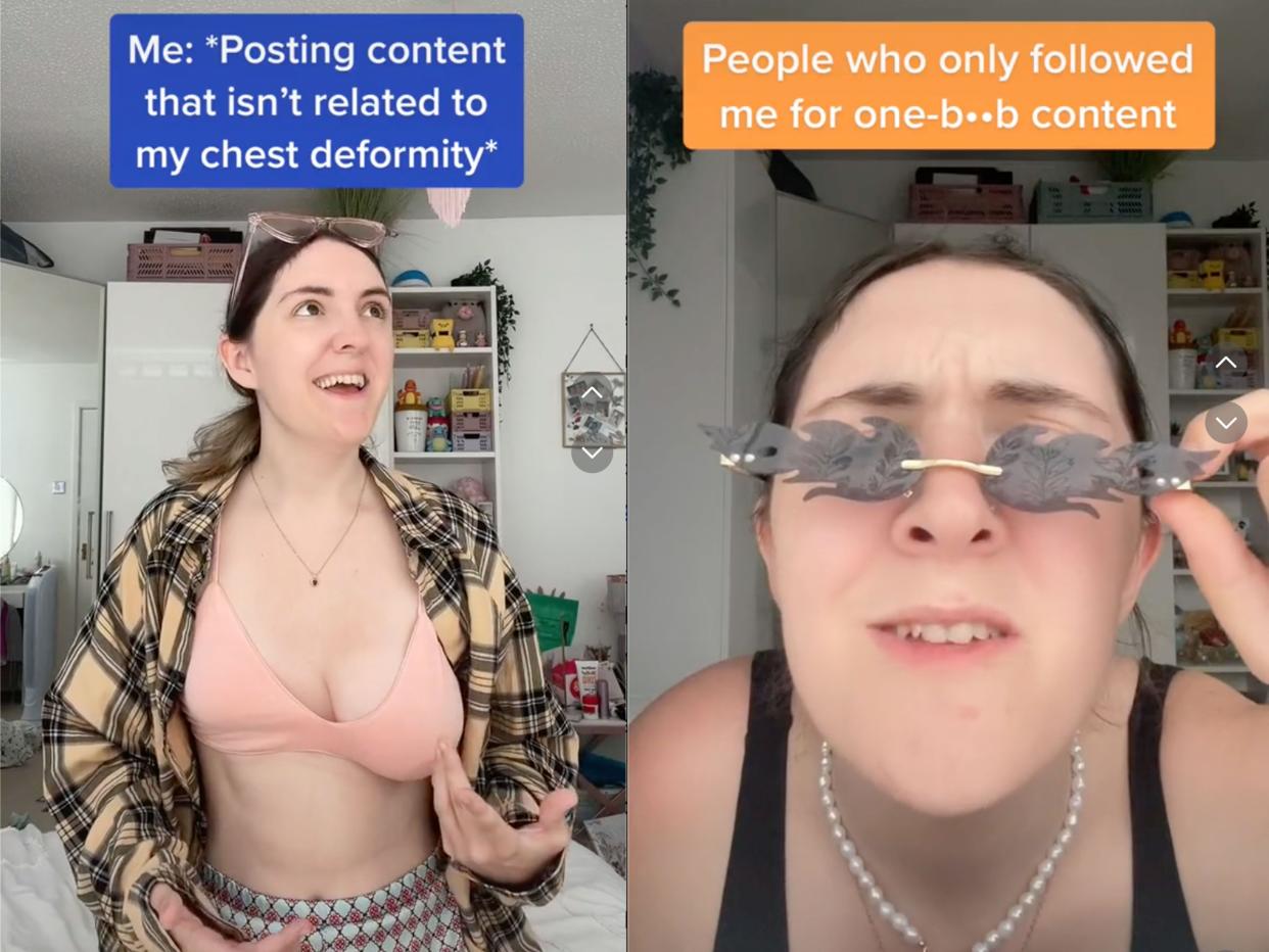 composite image of screenshots from becca butcher's tiktok. one the left reads on-screen text: "me: 'posting content that isn't related to my chest deformity'" and, on the right, on-screen text that reads: "people who only followed me for one b**b content"