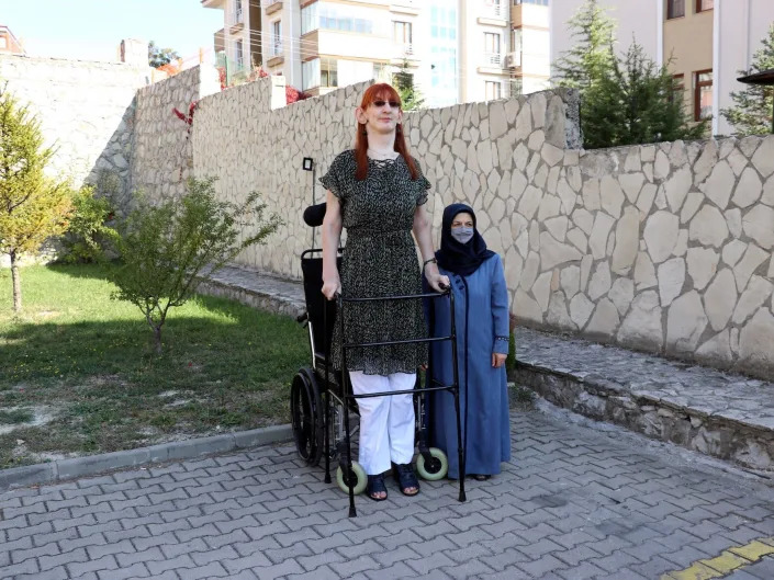 24-year-old Turkish woman Rumeysa Gelgi (L), who stands 215.16 centimeters (7 feet, 0.7 inches) tall and has been confirmed as the world's tallest living woman by Guinness World Records, is seen in front of her house in Safranbolu district of Karabuk, Turkey on October 14, 2021.