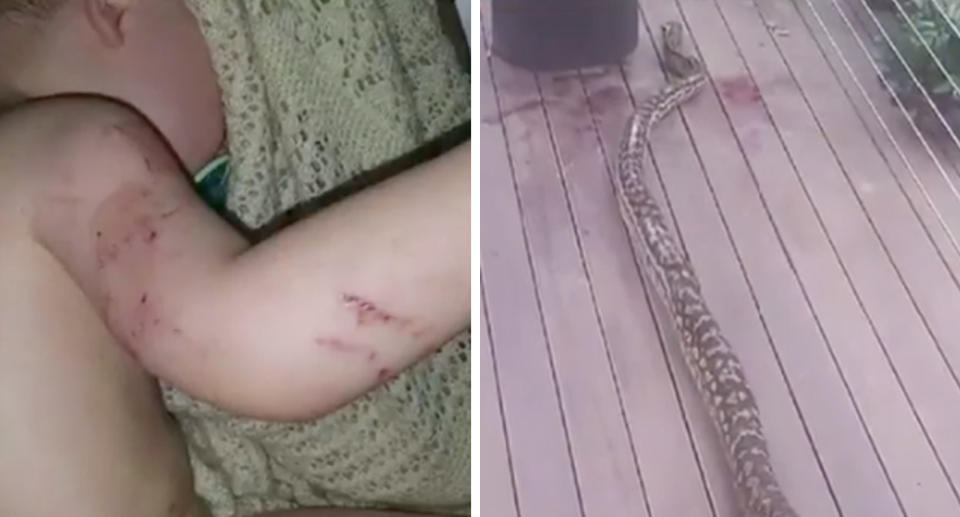 Young Naish's wounded arm (left) and the snake (right). 