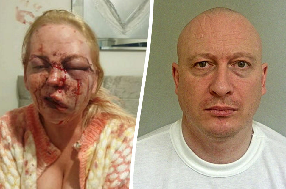 A woman shared pictures after she suffered horrific domestic abuse at the hands of Karl Machin  (right).