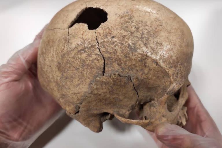Las marcas halladas en el cráneo de un hombre que vivió en el período Neolítico permitieron a un grupo de científicos deducir la manera en que esta persona murió