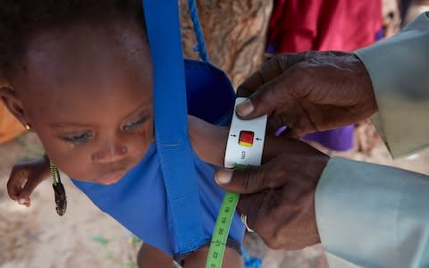 A child is weighed and arm measured at the Red Cross nutrition centre in the village of Kiéché, southern Niger - Credit: British Red Cross/Yuki Sugiura