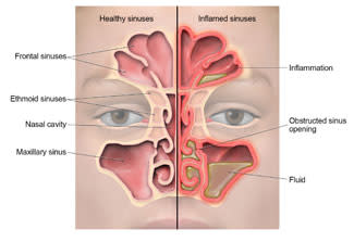 sinus massage (CDC)