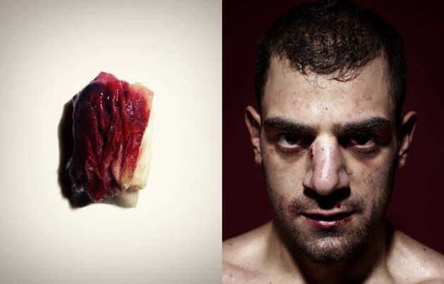 "Mixed Martial Arts (MMA) is a full-contact combat sport and one of the fastest growing sports today," say PALMER PAWEL, winners of the Sport category for this bloody shot.