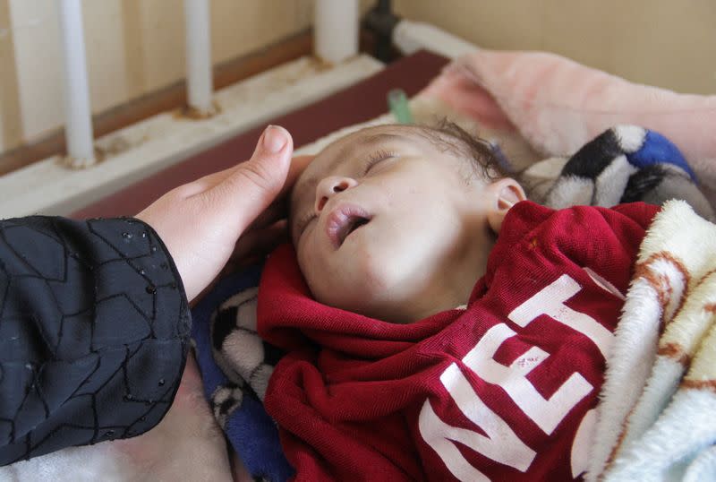 Palestinian children, who are suffering from malnutrition, receive healthcare at Kamal Adwan Hospital in northern Gaza Strip