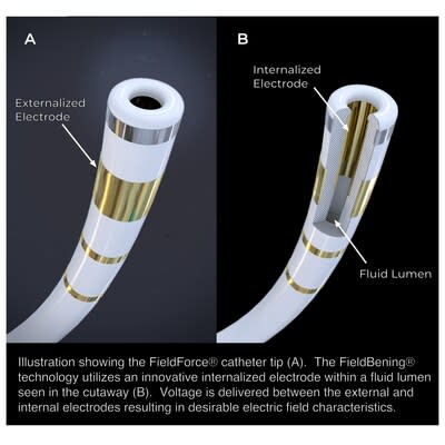 Cardiac ablation catheter