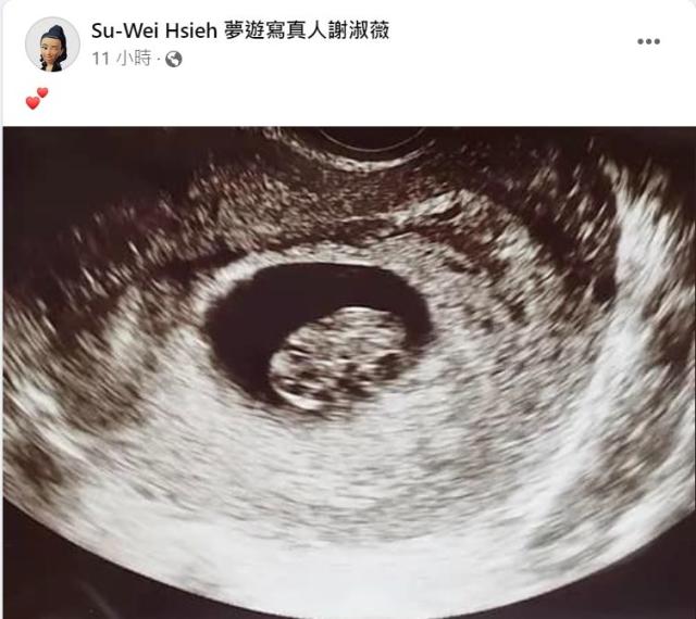 ▲愚人節當天，謝淑薇放上疑似懷孕的照片，引起熱議。取自Su-Wei Hsieh 夢遊寫真人謝淑薇