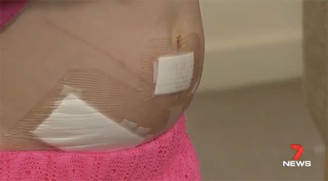 Wounds to Madison's stomach. Source: 7News