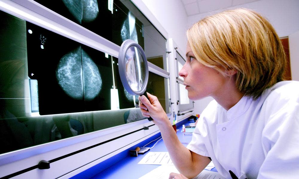 A radiologist examines mammograms on a lightbox with a magnifier