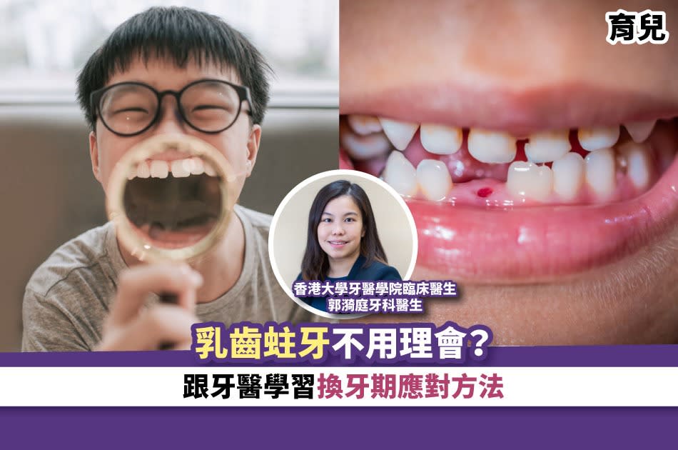 乳齒-蛀牙-拔牙-處理-換牙