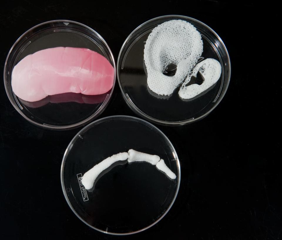 The Wake-Forest Institute for Regenerative Medicine (<a href="www.wfirm.org">WFIRM</a>) were the first to engineer lab-grown organs that were successfully implanted into humans. Pictured are the <a href="http://www.wakehealth.edu/Research/WFIRM/Research/Engineering-A-Kidney.htm">kidney</a>, ear and finger bone scaffolds printed with a 3D printer (these tissues are experimental and not yet ready for patients). There are <a href="http://www.wakehealth.edu/Research/WFIRM/Blood-Vessel/Cell-and-Tissue-Types.htm">30 replacement tissues </a>currently being developed by the WFIRM team. <a href="http://www.wakehealth.edu/WFIRM/">Learn more about WFIRM's research</a>.