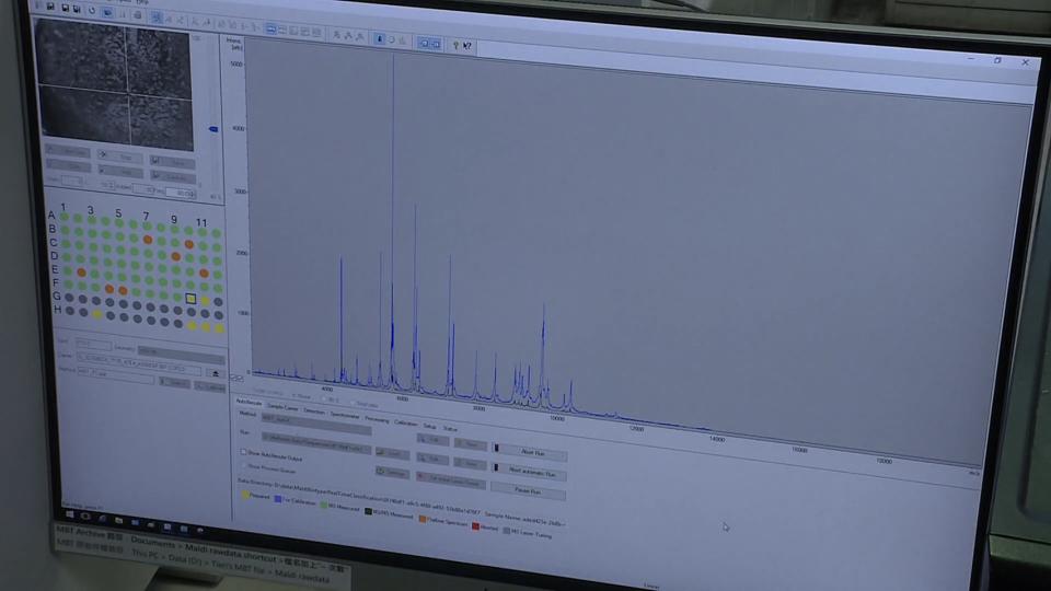 透過大數據的訓練可以讓機器去學習，直接從質譜的波形判讀，進一步去判定細菌是否有抗藥性。（圖／獨立特派員）