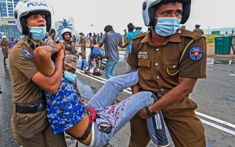  Policemen carry an injured man during a clash between government supporters and demonstrators outside the President's office in Colombo - ISHARA S. KODIKARA/AFP 