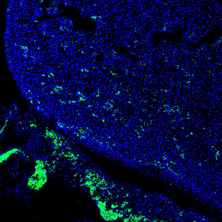 Human cells (green) contributed to a developing heart of 4-week-old pig embryo (Salk Institute)