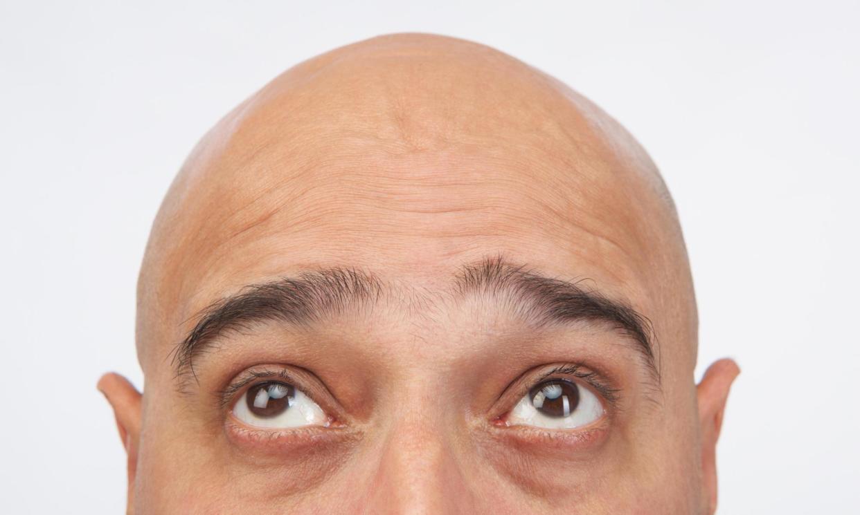 <span>‘Like Stuart, when I finally shaved my head and accepted my fate, the sense of release was overwhelming.’</span><span>Photograph: SD/Alamy</span>