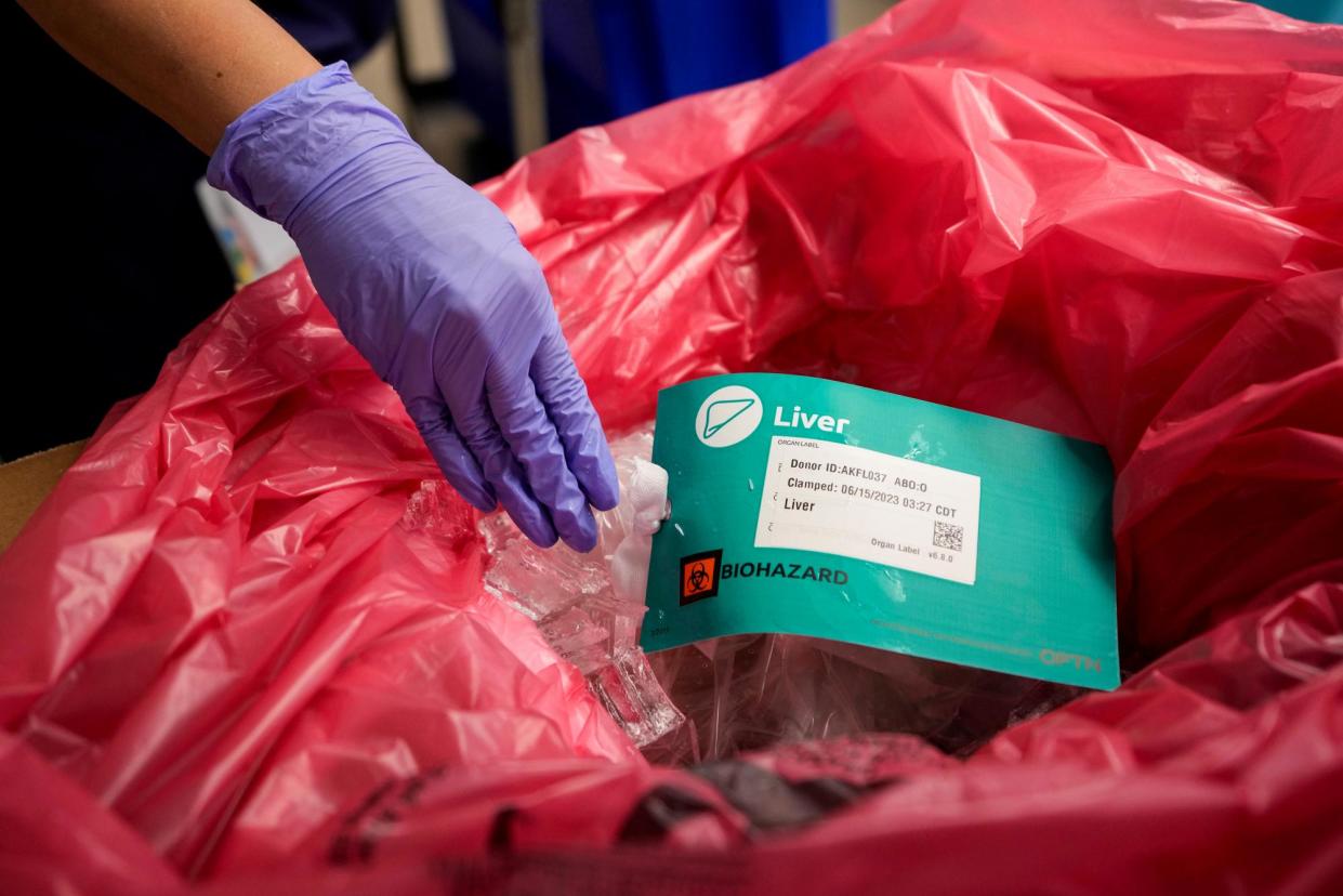 <span>A liver is prepared for transport after it has been removed from an organ donor in Jackson, Tennessee, on 15 June 2023.</span><span>Photograph: Mark Humphrey/AP</span>