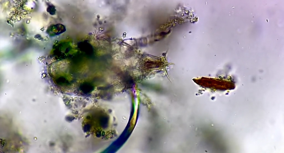 A close-up of a mite at 400 time magnification inside a washing machine filter