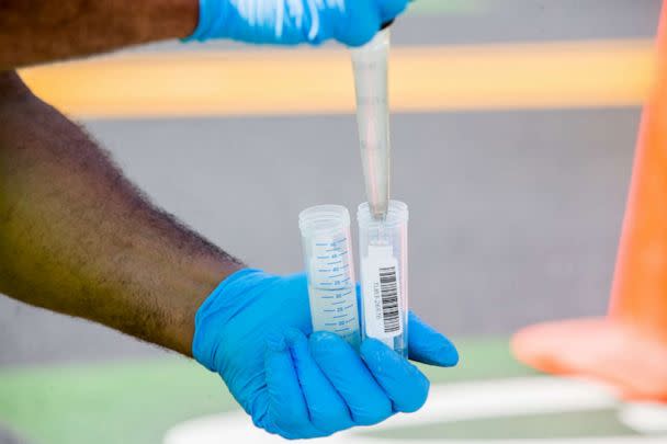 PHOTO: A Chelsea Water and Sewer Department worker performs a test on a wastewater sample for the presence of Covid-19 in Chelsea, Mass., July 27, 2021.   (Bloomberg via Getty Images)