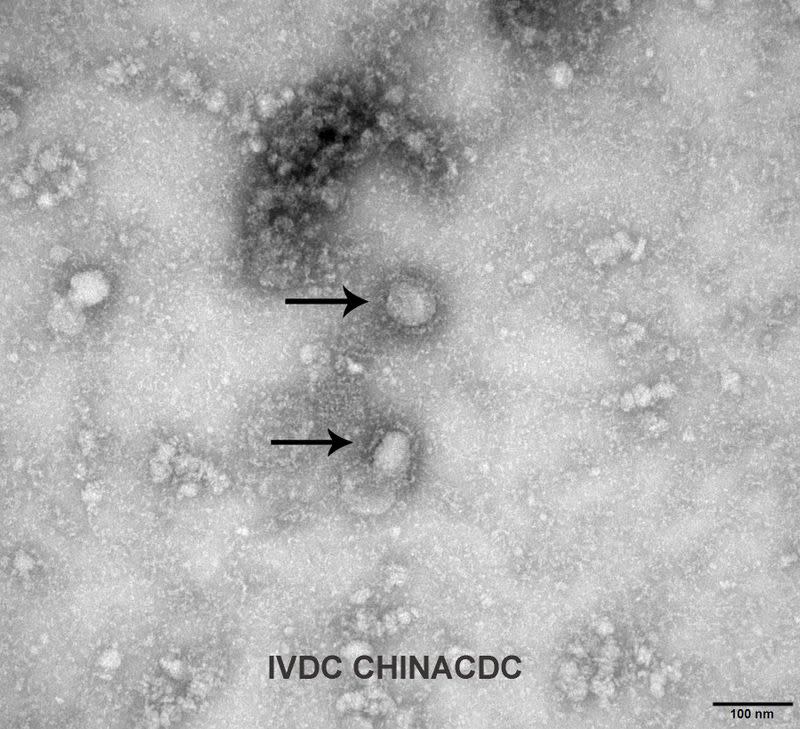 A Transmission Electron Microscopy image of the first isolated case of the coronavirus