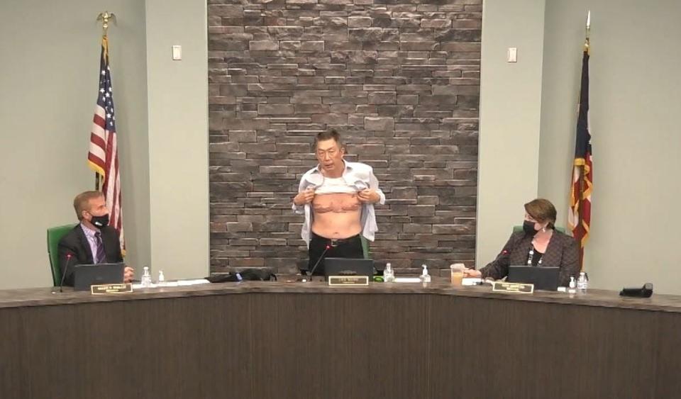West Chester Township Board of Trustees President  Lee Wong shows scars that he received fighting in the U.S. military as he decries racism against Asian Americans at the March 22 meeting of the board of trustees.