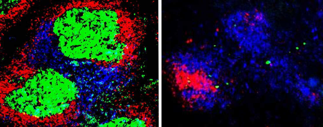 <div class="inline-image__caption"><p>Fluorescent microscopy of T and B cells in mice. On the left, you can see the germinal center forming in the spleen of normal mice infected with malaria. On the right, the germinal center does not form in mice that cannot produce a functional TBK1 enzyme. </p></div> <div class="inline-image__credit">Michelle S.J. Lee</div>
