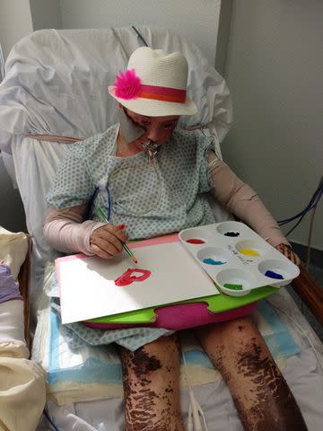 <p>Shriners Children's</p> Paige Lacombe in the hospital for SJS