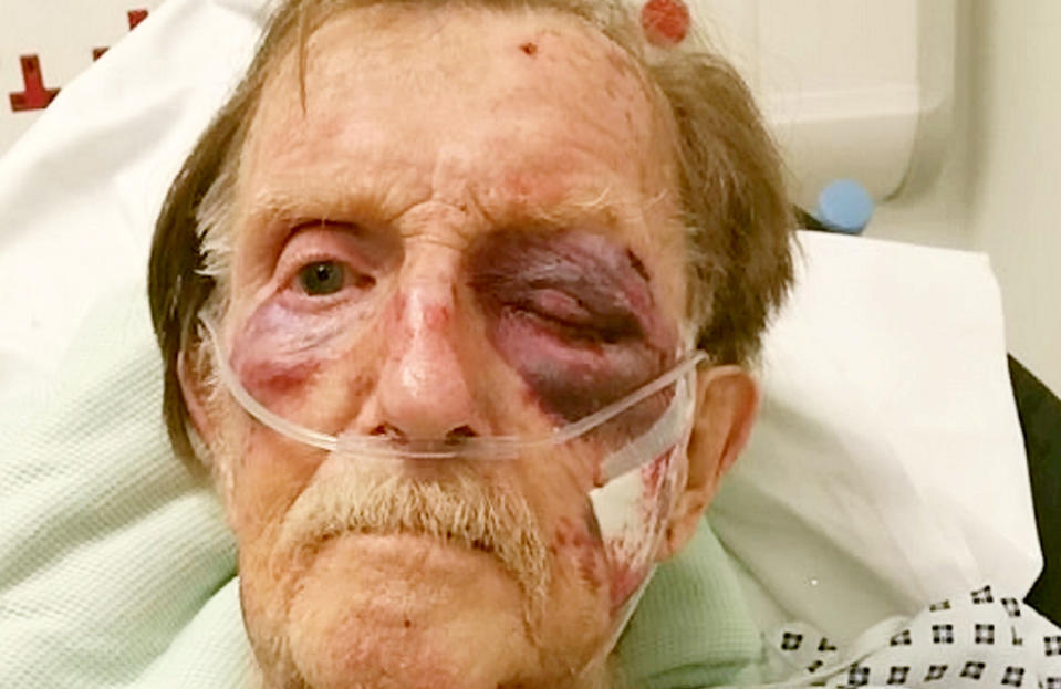 <em>Attacked – Arthur Gumbley died three weeks after thugs brutally battered him in his own home (Picture: SWNS)</em>