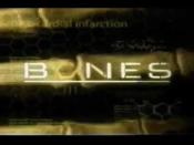 <p>Bones follows forensic anthropologist Dr Temperance Brennan as she investigates murders with the help of F.B.I. agent Seeley Booth.</p><p>There are a whopping 245 episodes available, so it's sure to keep you busy. </p><p><a href="https://www.youtube.com/watch?v=Hm1qIGHBeak" rel="nofollow noopener" target="_blank" data-ylk="slk:See the original post on Youtube;elm:context_link;itc:0;sec:content-canvas" class="link ">See the original post on Youtube</a></p>