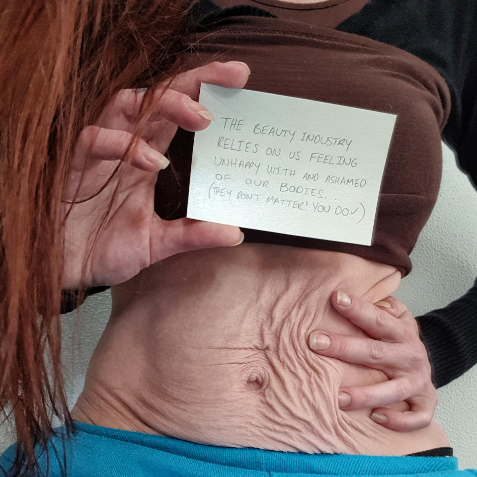 A photo of Sherie Grant baring her stomach.