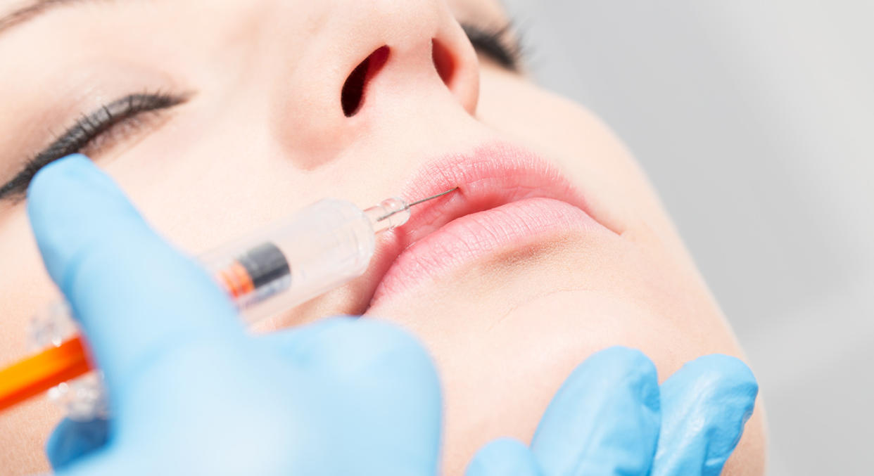 There is currently no minimum age limit for lip fillers in the UK [Photo: Getty]