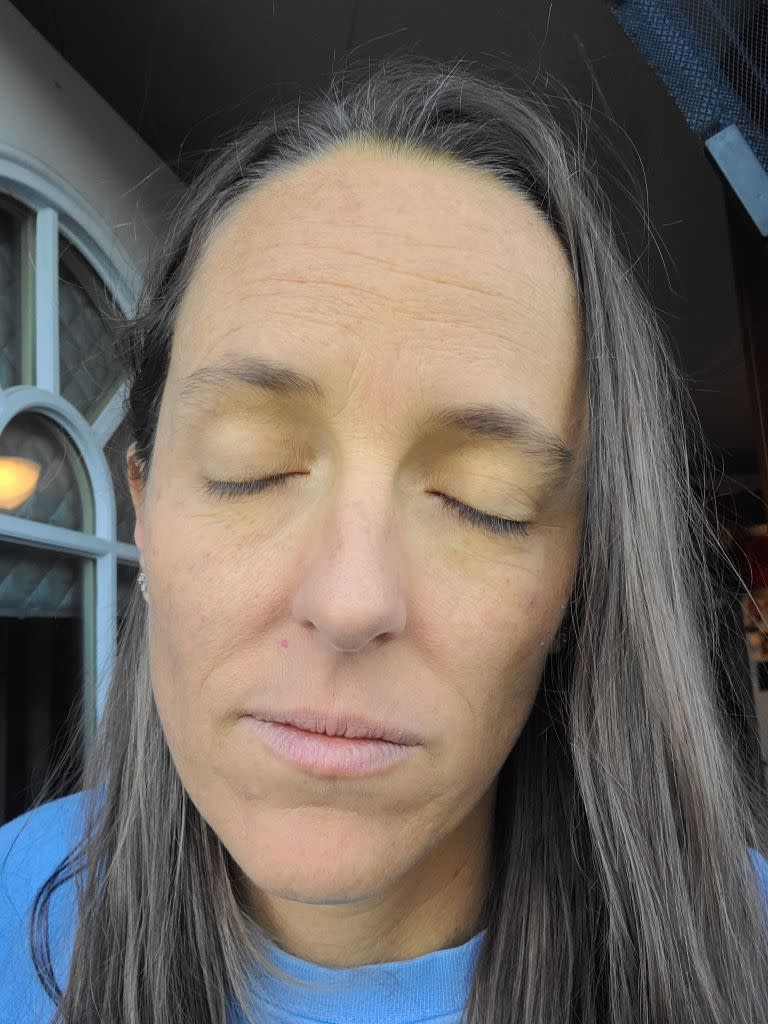 After six weeks of taking the supplement, the mom started experiencing stomach pains, which quickly worsened. She subsequently noticed her skin and eyes “looking a bit yellow.” KennedyNews/AmberHeimbach