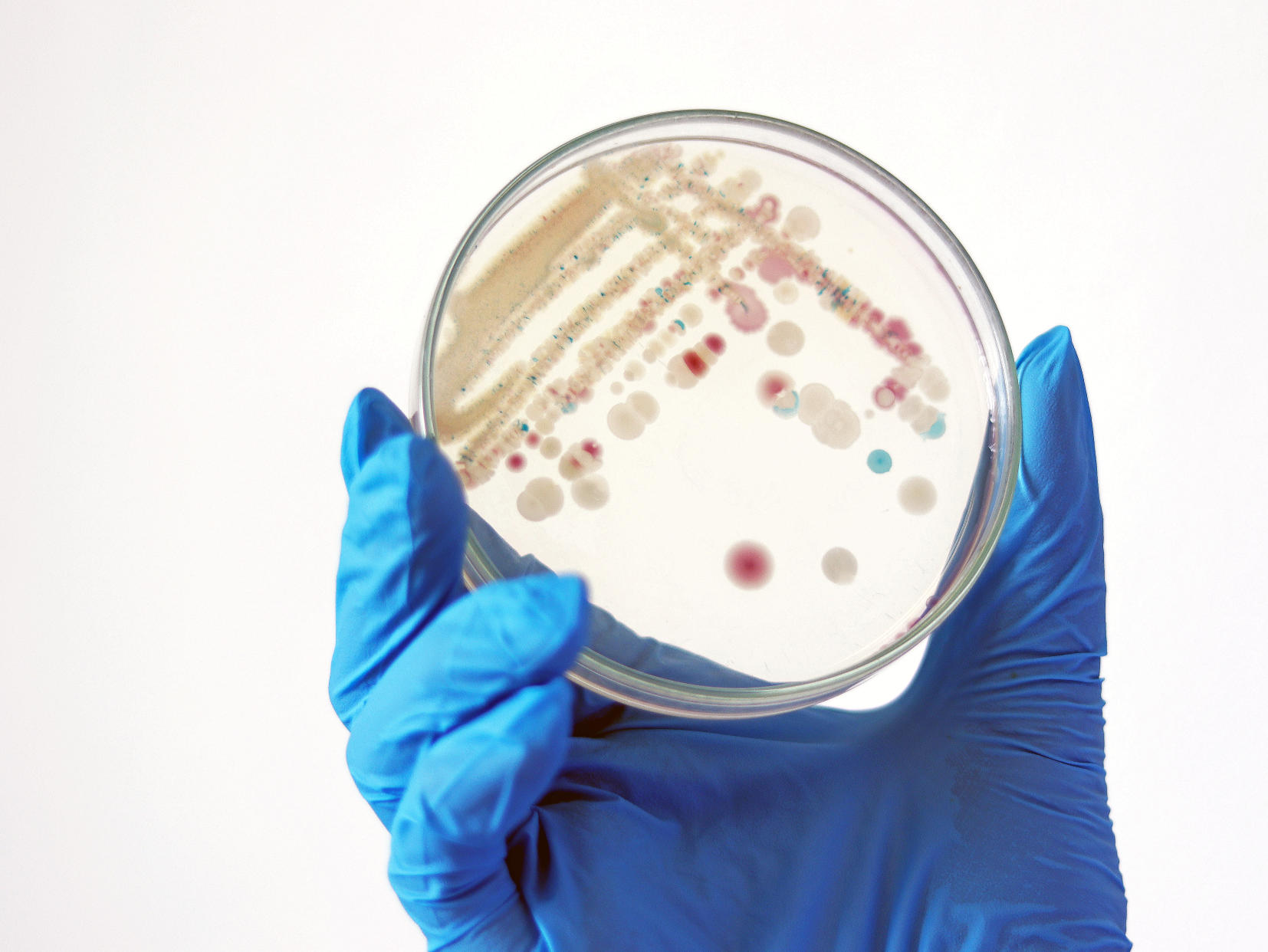 Researcher is holding Petri dish of Vibrio vulnificus in CHROMagar and TCBS, an estuarine bacterium which occurs in in filter-feeding molluscan shellfish, such as oysters., ingestion of the bacterium.Vibriosis is an infection caused by several species of a group of bacteria called Vibrio. 